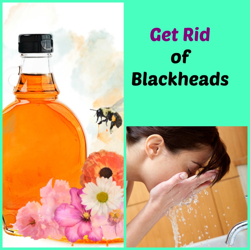 get rid of blackheads