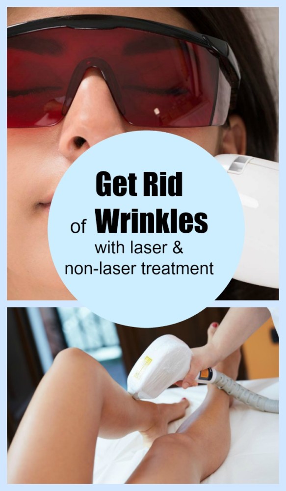 Laser Treatment wrinkles